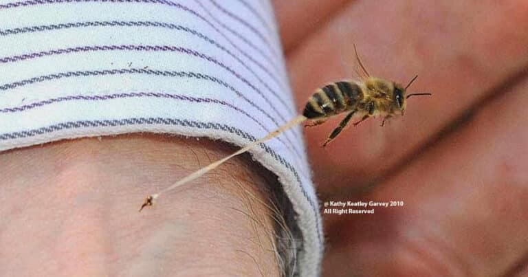 Anatomy Of A Bee Sting