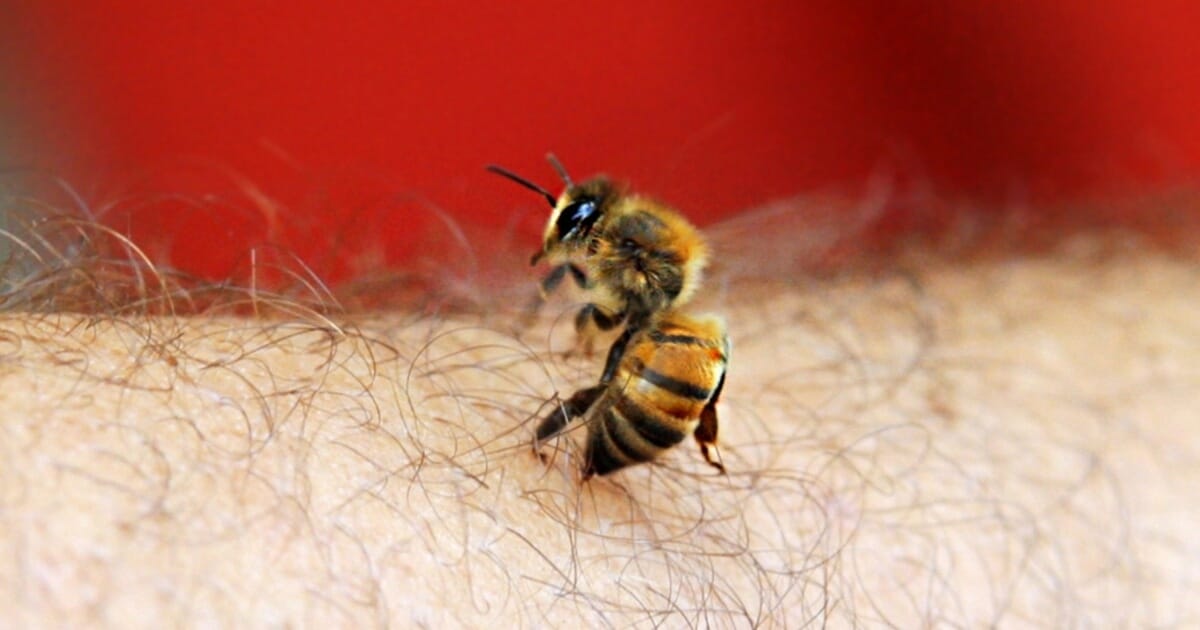 A bee stinging a man's arm
